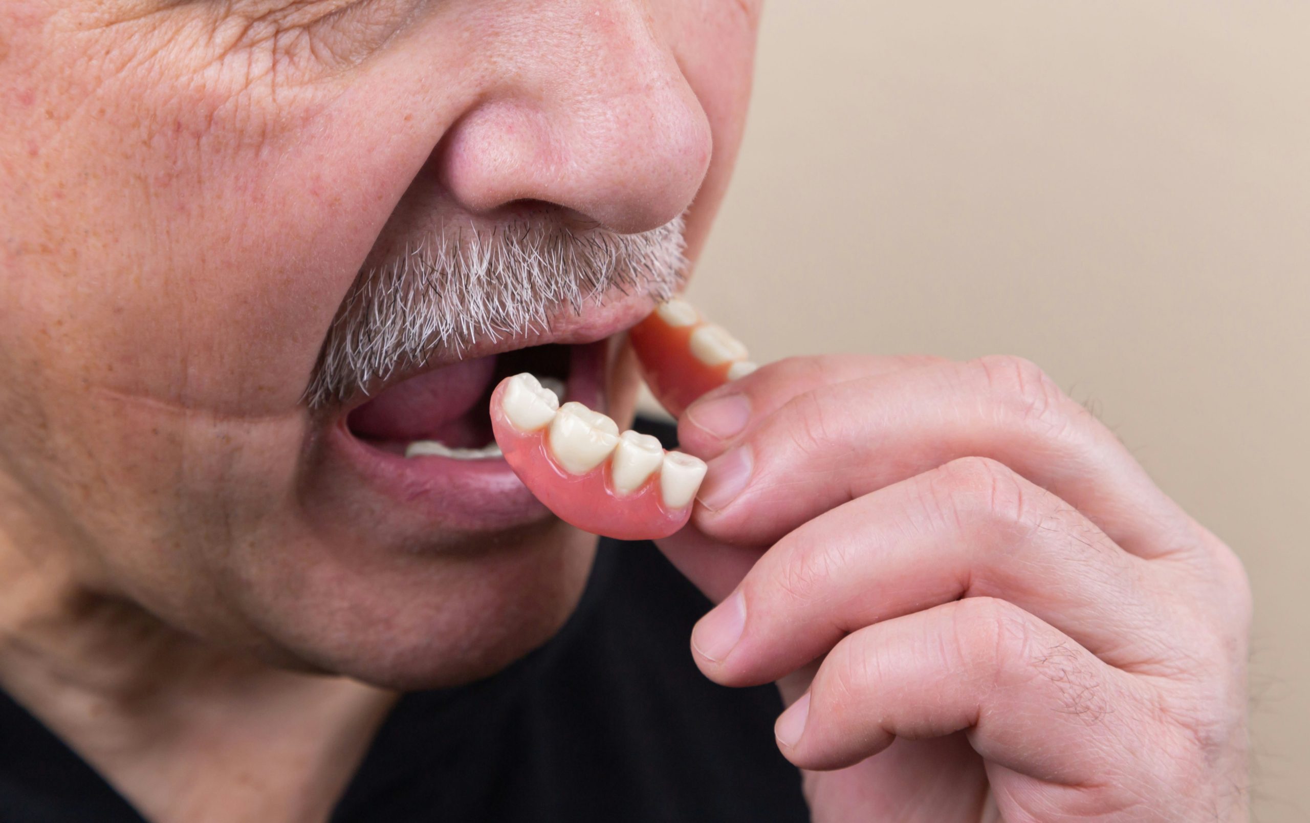 The Ultimate Guide to Dentures: What You Need to Know