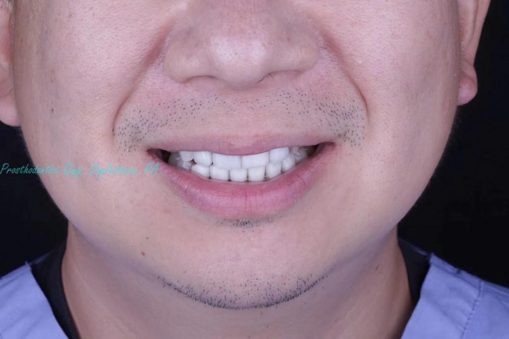 A dentist’s own journey of smile makeover