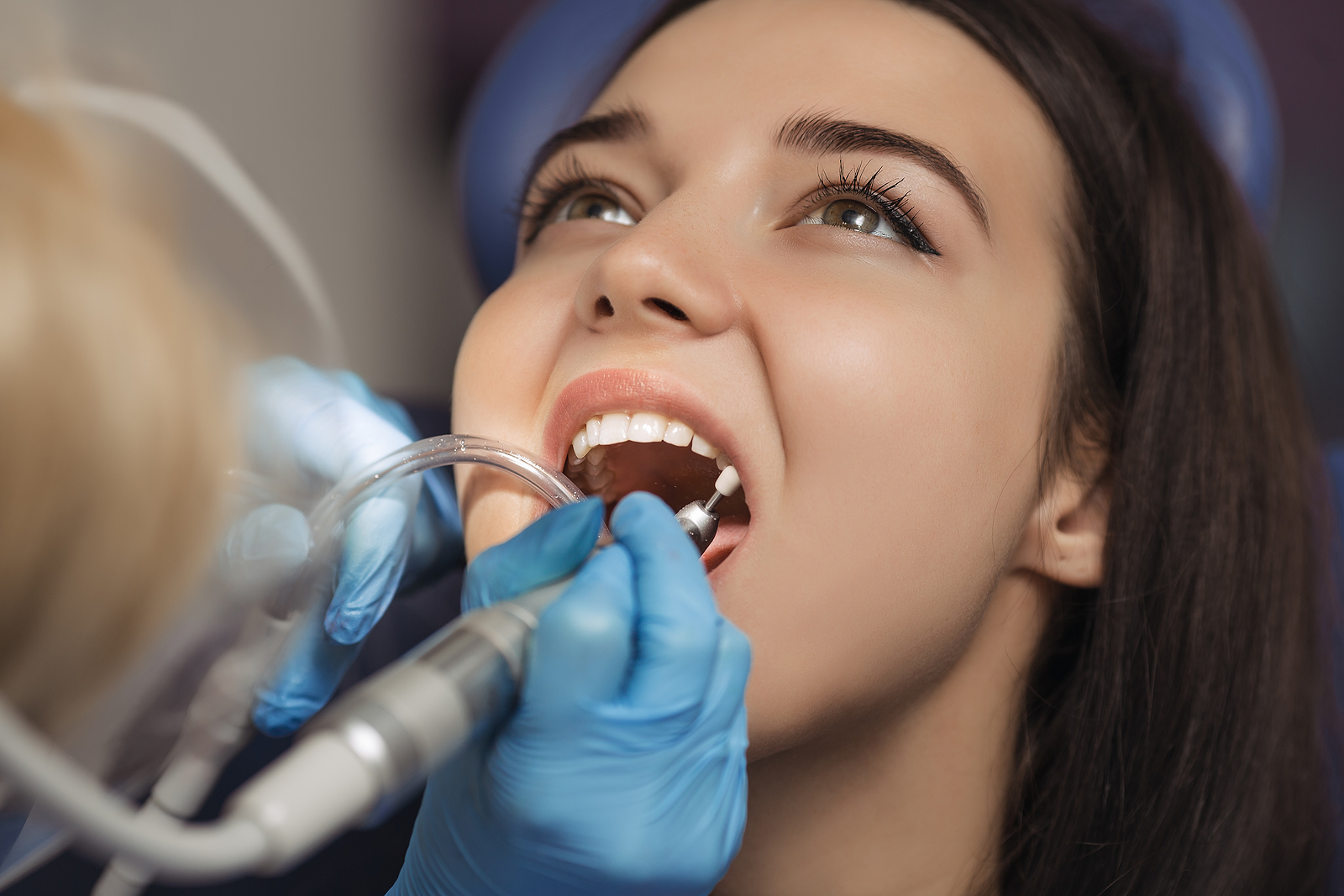 The Game-Changing Benefits of Dental Implants for Restorative Dental Care