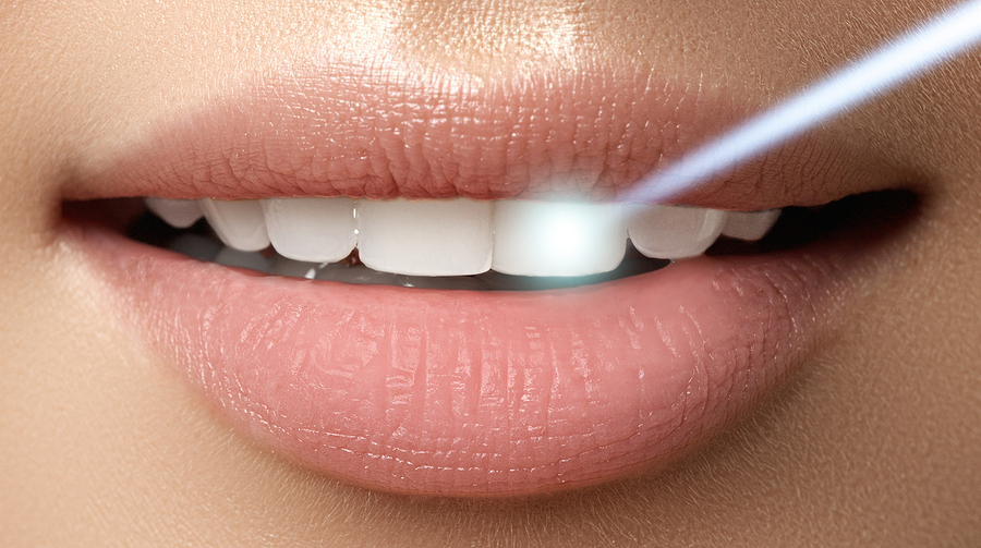 Achieve a Radiant Smile with Zoom Whitening in Lansdale, PA